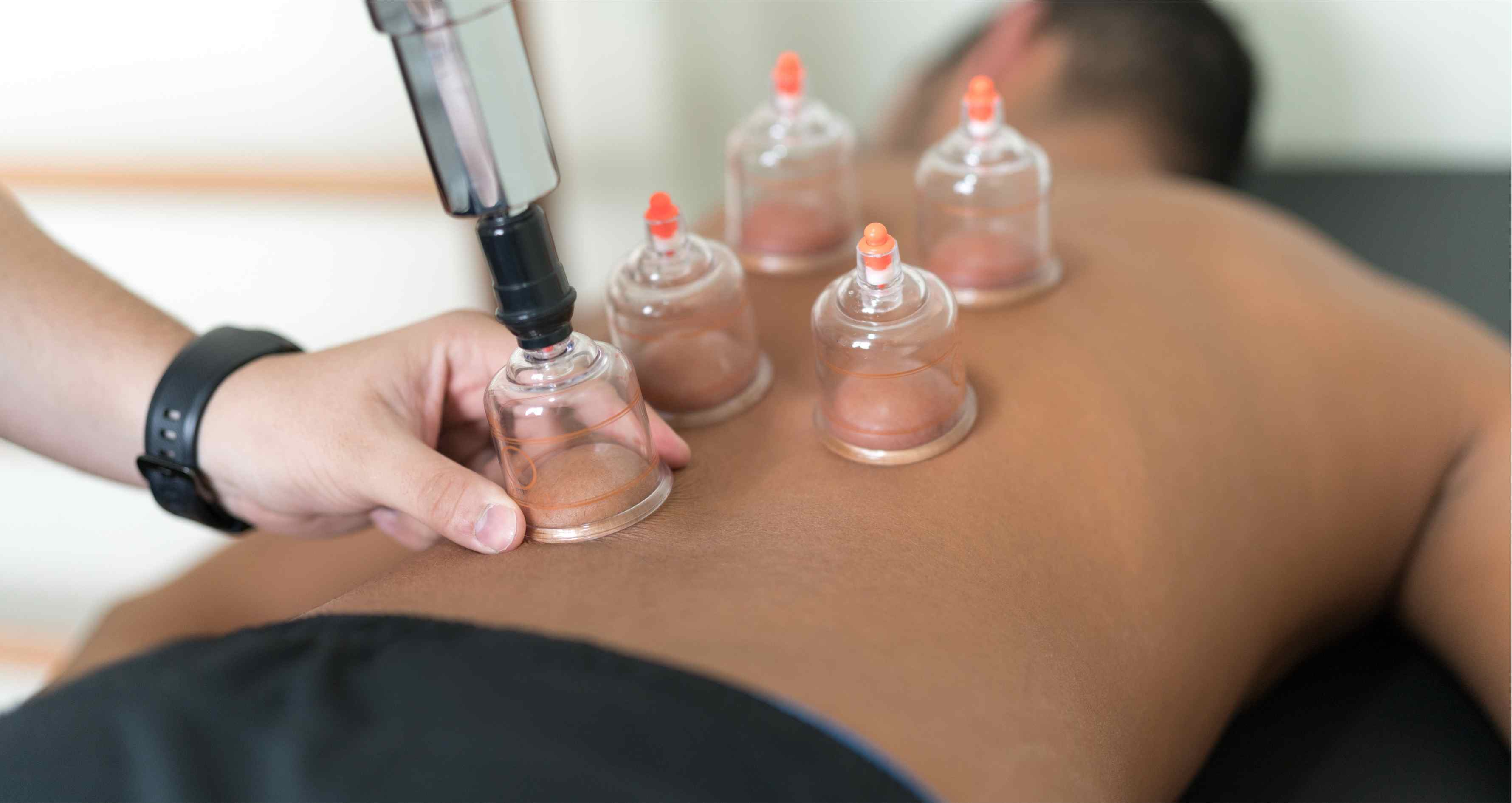 الحجامة الطبية 